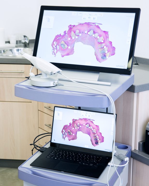3d-teeth-scans-on-computer-and-laptop-in-dentist-o-2025-03-09-16-31-21-utc